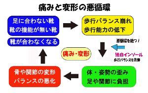 痛みの悪循環図